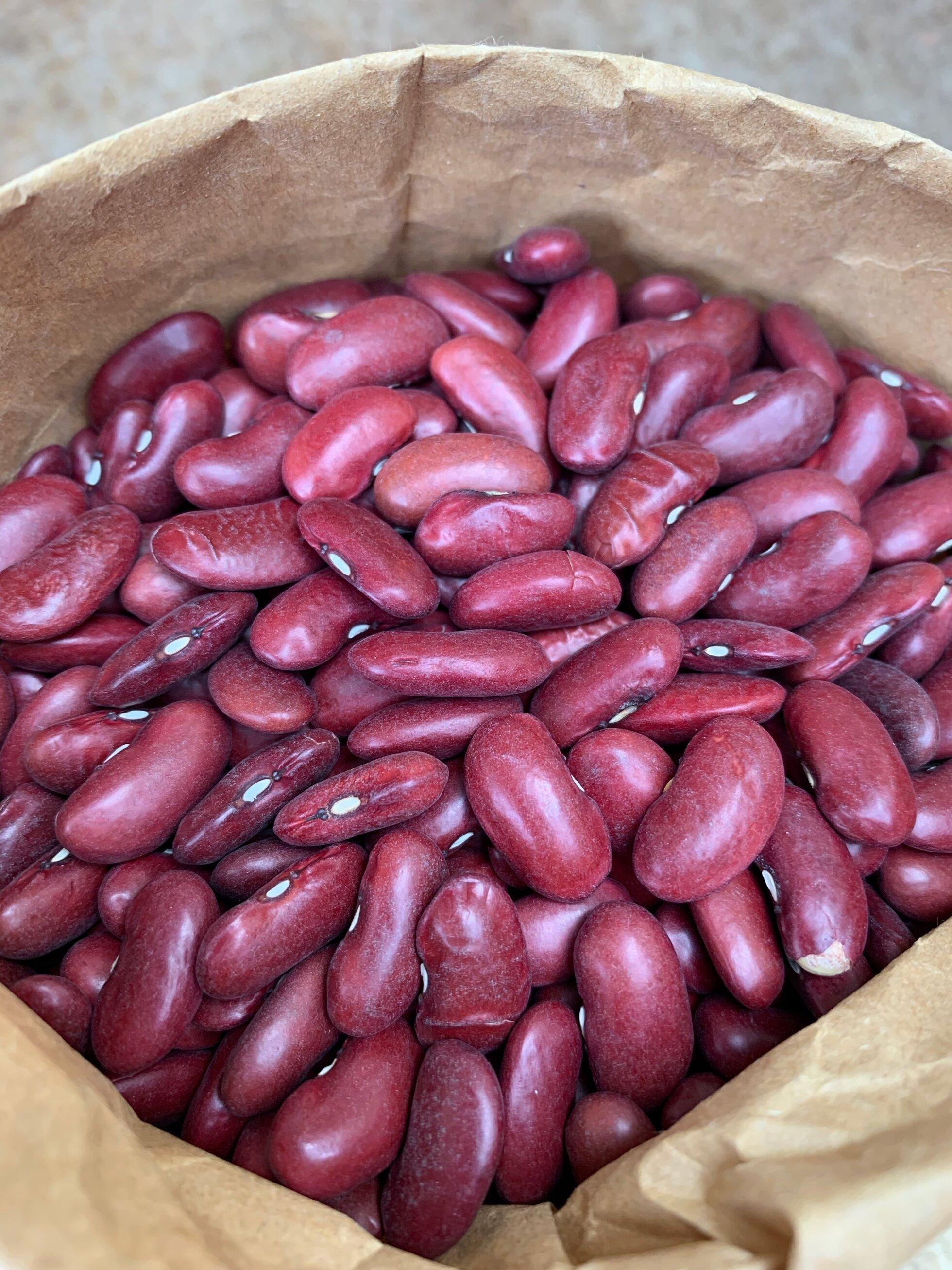 Kidney Beans Ash ≤ 5% Fat 0.5–2% Fiber 15–25% Purity ≥ 99% Protein 20–25% Damaged Beans ≤ 1% Broken Beans ≤ 0.5% Origin South